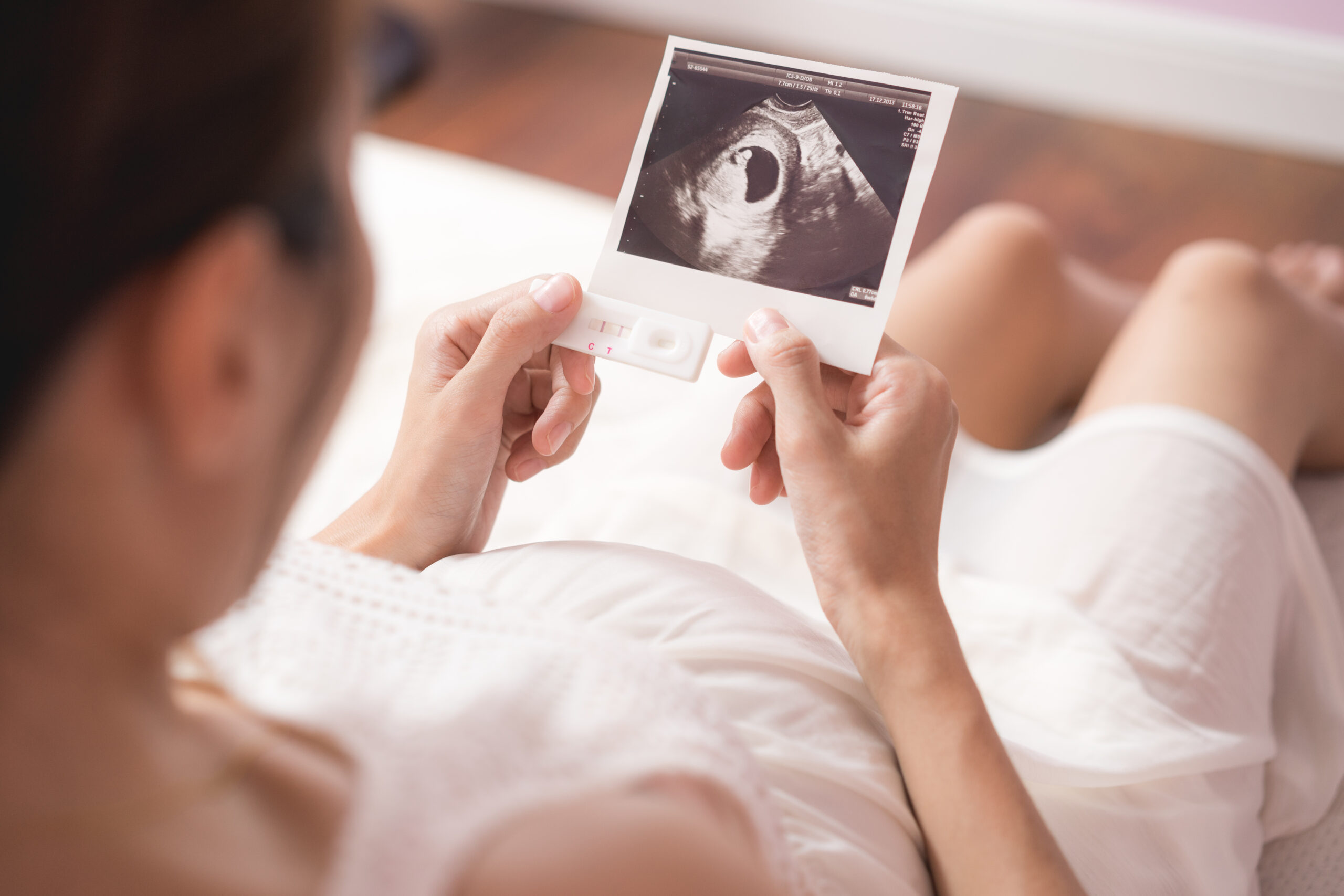 Ecografía morfológica en Málaga para estudio fetal en la semana 20